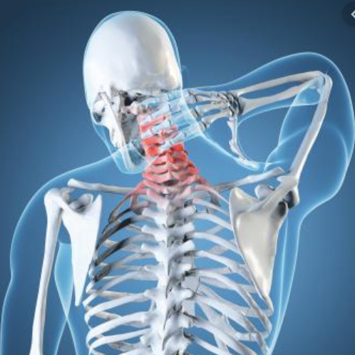 Treating Whiplash - Torsional Release Technique - Niel Asher Education