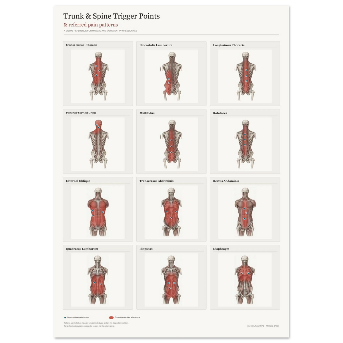 Trunk & Spine Trigger Points & Referred Pain Patterns