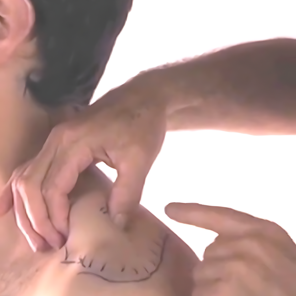 Tension Headache and Trigger Points (4 hrs)