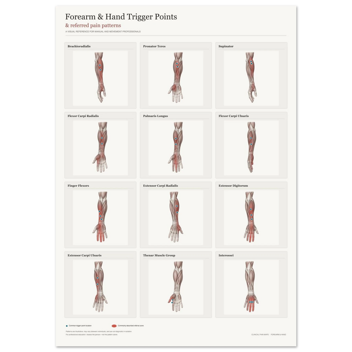 Forearm & Hand Trigger Points and Referred Pain Patterns