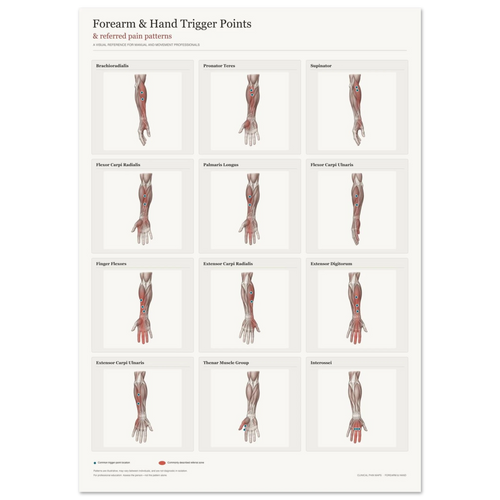 Forearm & Hand Trigger Points and Referred Pain Patterns