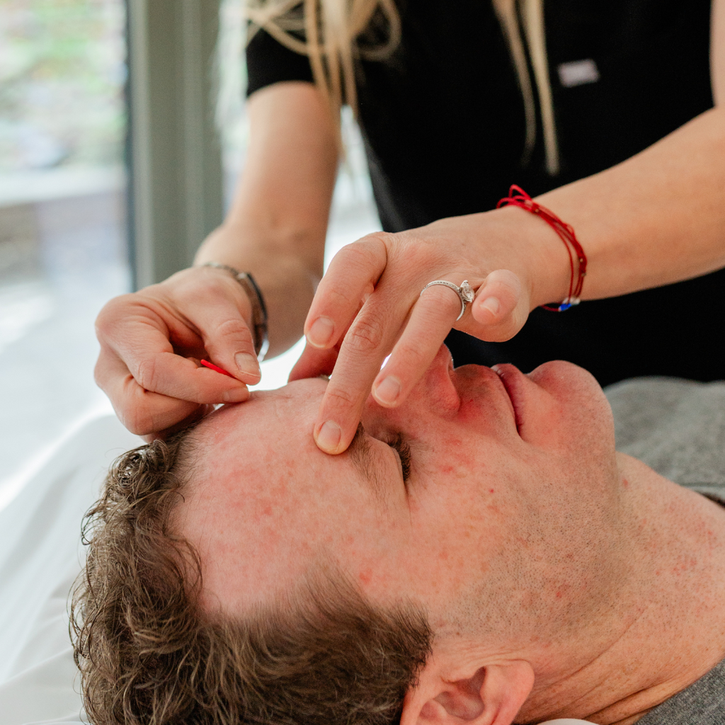 Foundation in Acupuncture (Level 1)