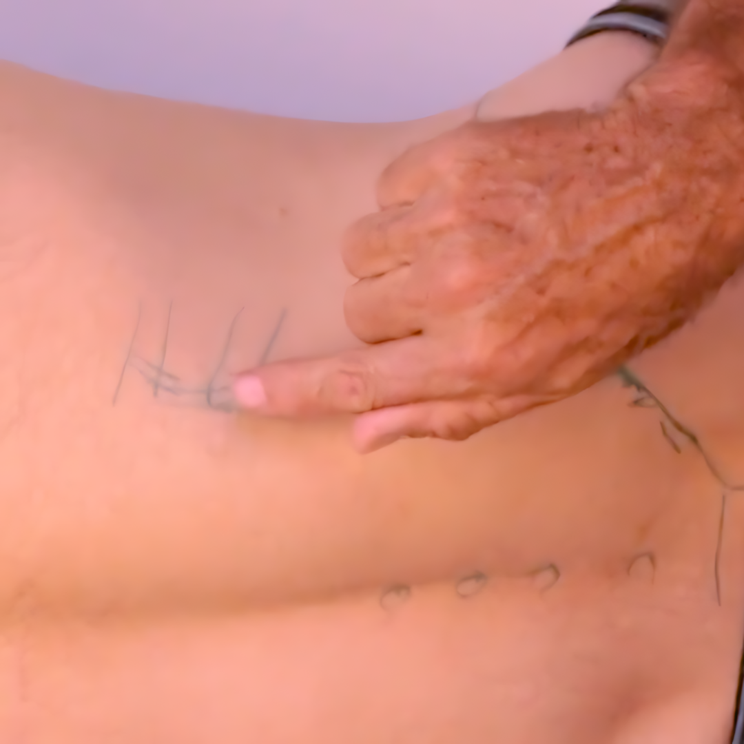 Tratamiento del dolor lumbar - Curso de puntos de activación NAT (3.5 CEU) 