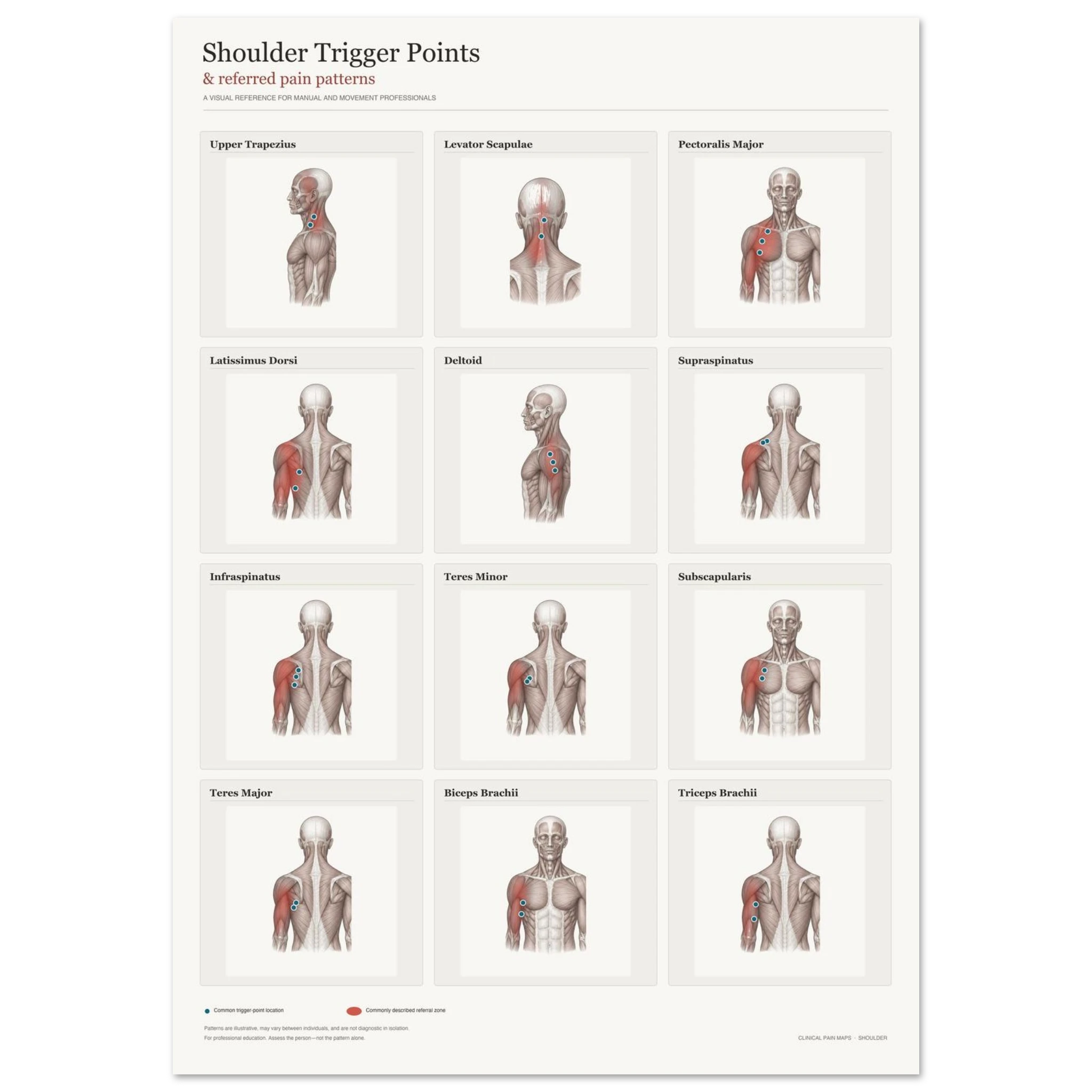 Shoulder Trigger Points & Referred Pain Patterns