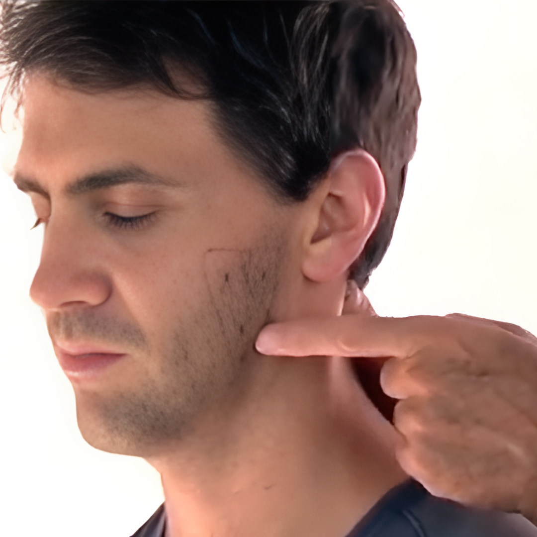 Tension Headache and Trigger Points (4 hrs)