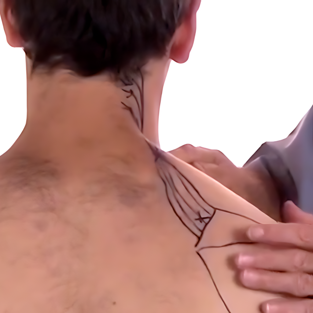 Tension Headache and Trigger Points (4 hrs)