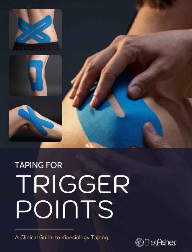 Taping for Trigger Points (4 hrs)