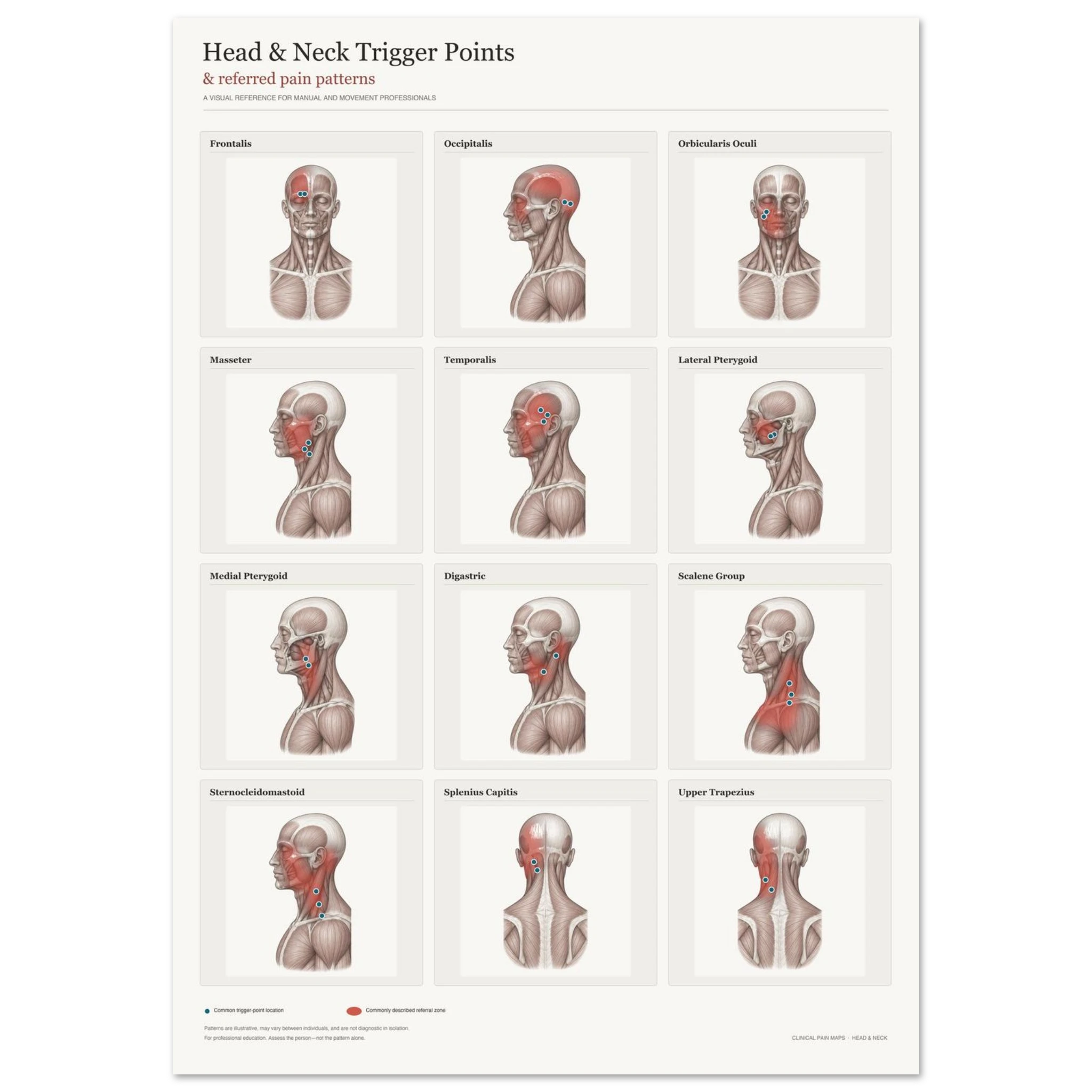 Head & Neck Trigger Point Anatomy Poster | A1 Clinical Wall Art