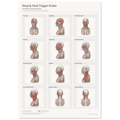 Head & Neck Trigger Point Anatomy Poster | A1 Clinical Wall Art